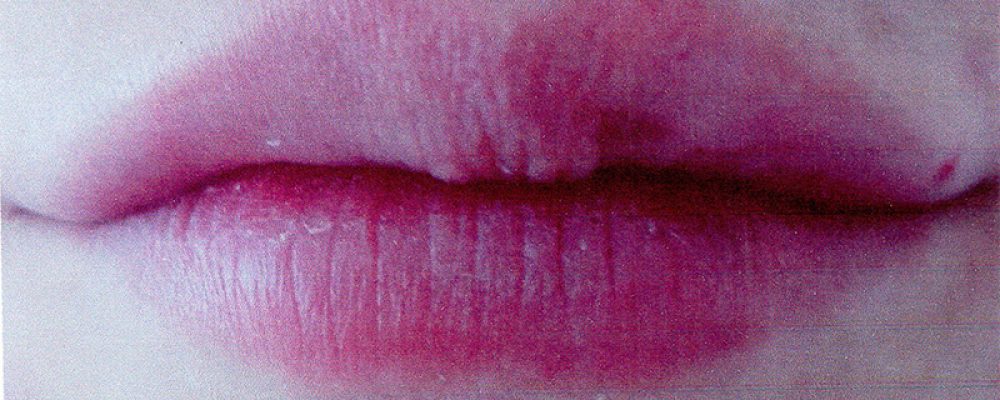 Filler labbra… non solo volume!