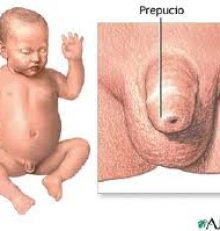 Fimosi
