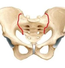 Il dolore della articolazione sacroiliaca